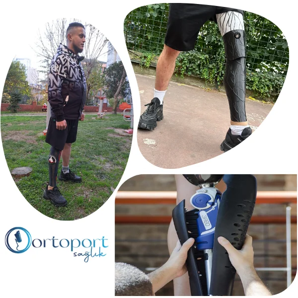 protez kaplama cover