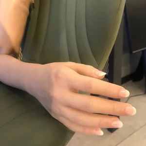 silikon el protezi